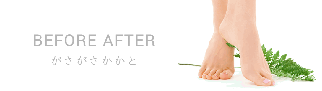 フットケア・巻き爪のビフォーアフターが見れる神奈川の川崎や横浜に展開するフットケアサロン心逢の写真3
